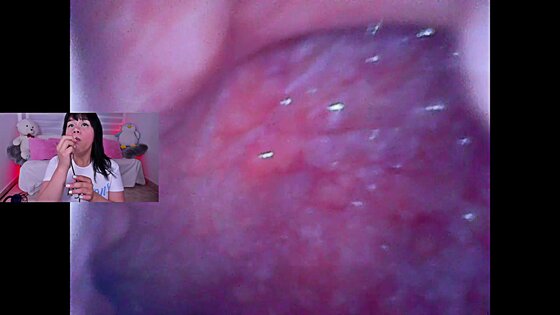 brackets lila🙂ster🍓^)porn videos